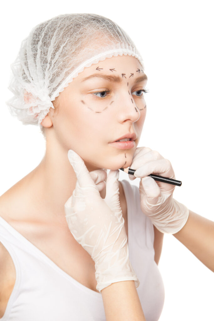 Surgeon performing preoperative markings on a patient's face to map incision lines for an Face lift UK.