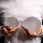 A close-up view of a woman wearing a white long-sleeve ribbed top, holding two different-sized semi-translucent textured silicone breast implants in her hands against a dark background to demonstrate sizing options for a Natural Looking Breast Augmentation in UK.