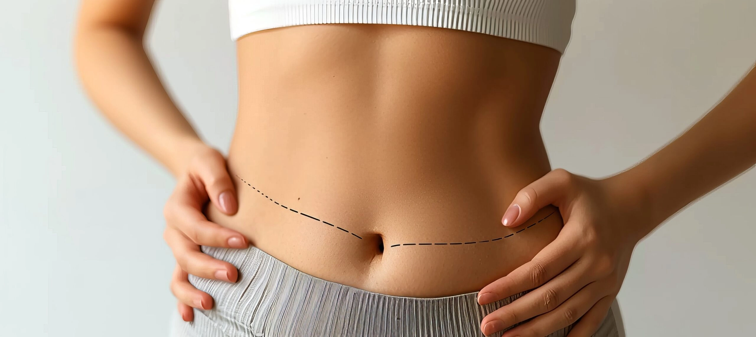 A close-up view of a woman's midsection with her hands resting on her hips, showing a dashed black surgical marking line drawn across the lower abdomen below the umbilicus to plan for a liposuction surgery in UK.