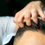 A close-up view of a clinician's hand running fingers through a man's thick dark hair to evaluate follicle distribution and frontal recessing for a FUE hair transplant UK procedure.