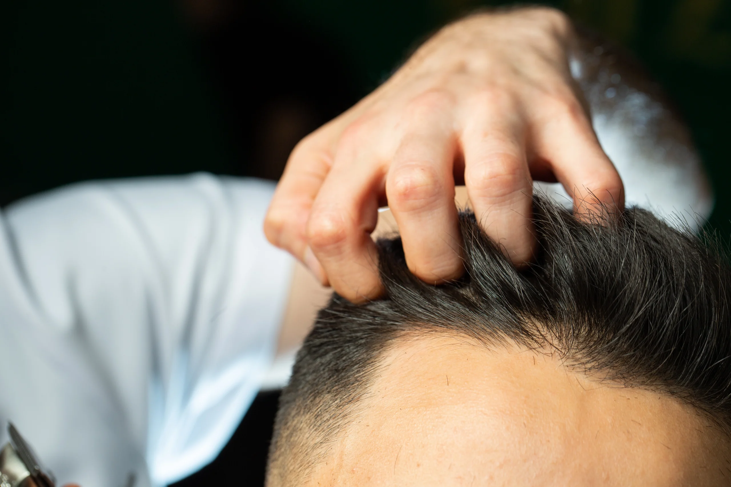 A close-up view of a clinician's hand running fingers through a man's thick dark hair to evaluate follicle distribution and frontal recessing for a FUE hair transplant UK procedure.