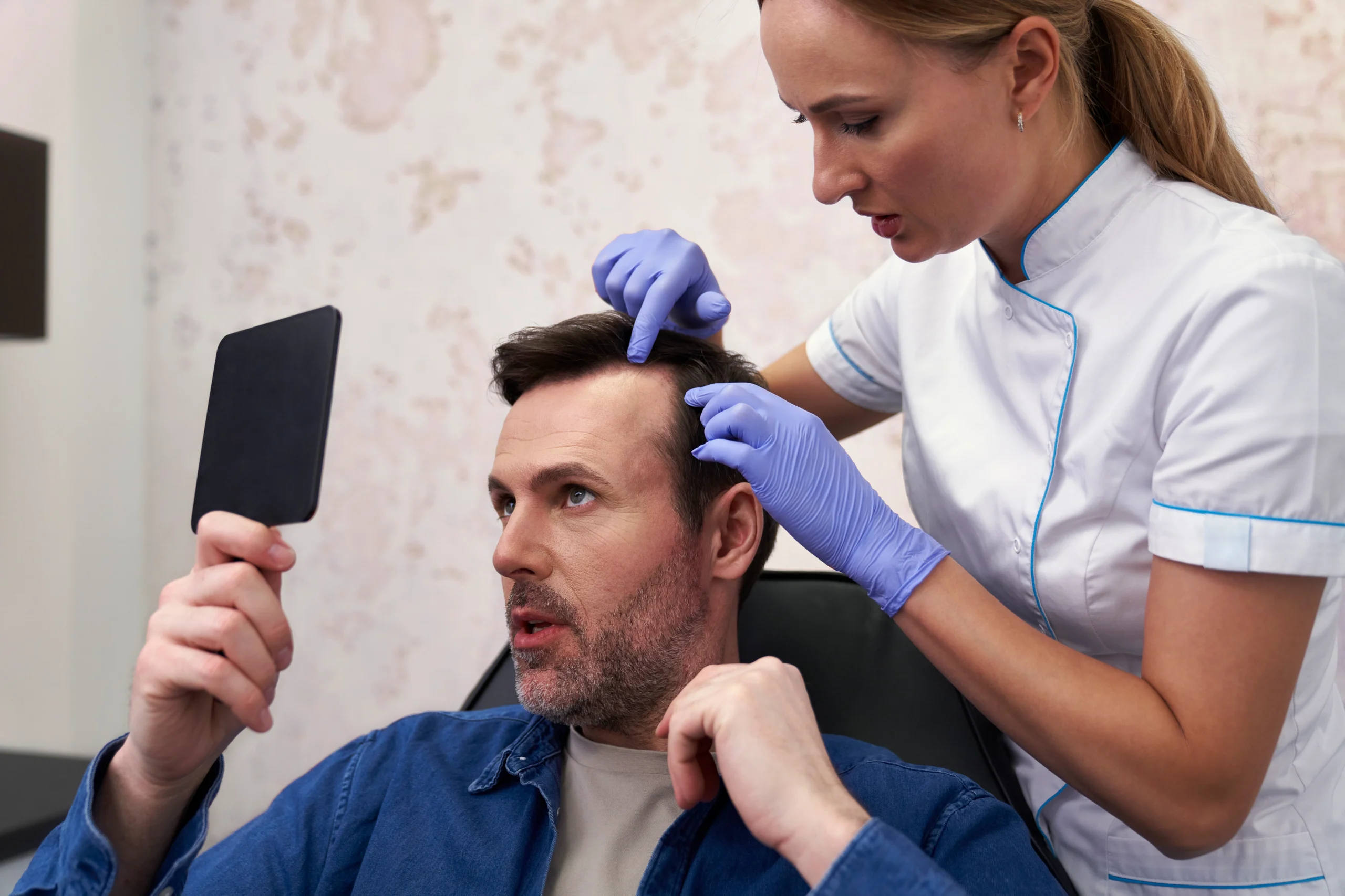 A close-up view of a trichologist wearing purple gloves examining a man's receding hairline while he looks into a hand mirror, analyzing long-term graft survival factors related to Does a FUE hair transplant last forever UK.