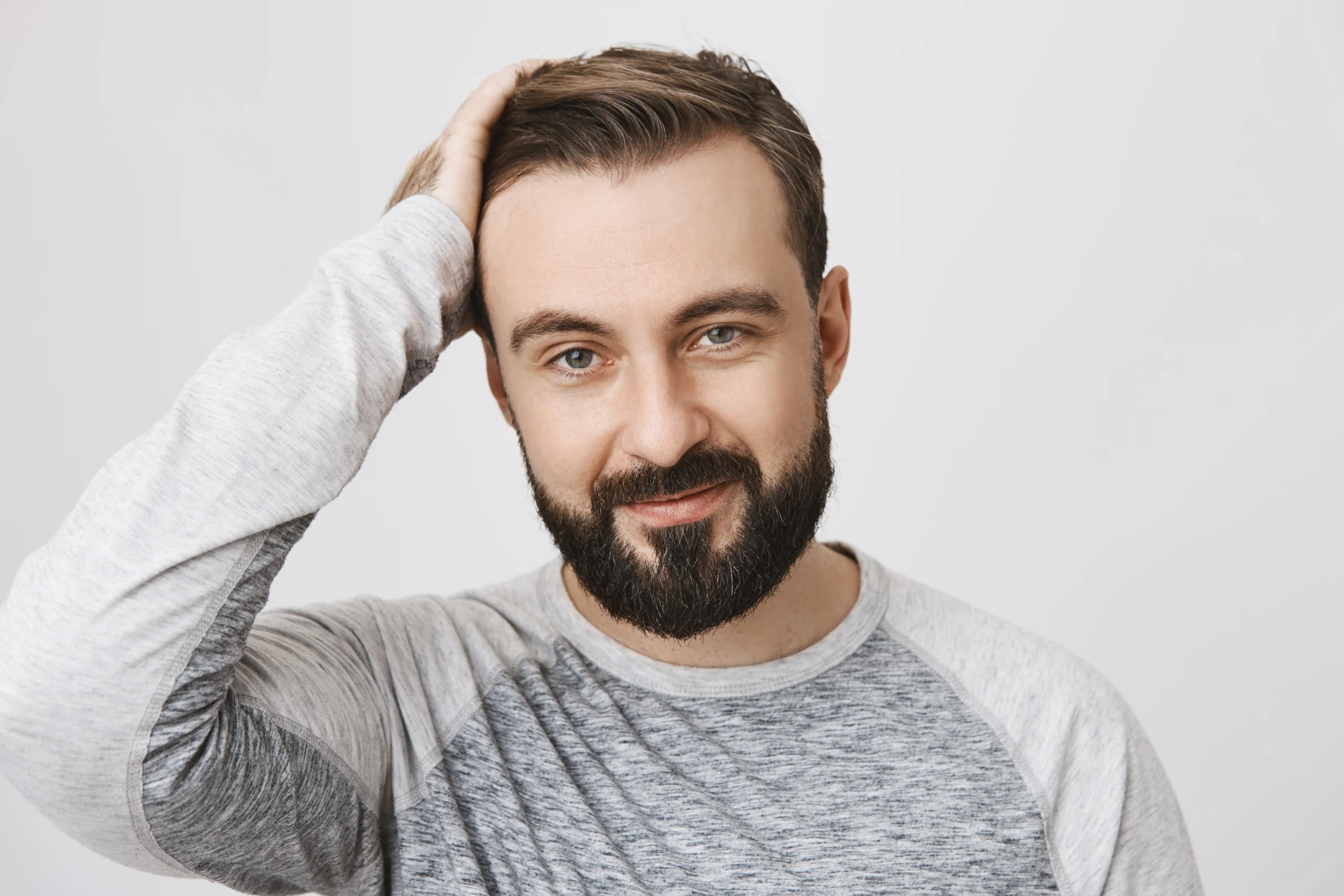 Patient displaying natural follicular growth and restored density after a successful hair transplant UK.