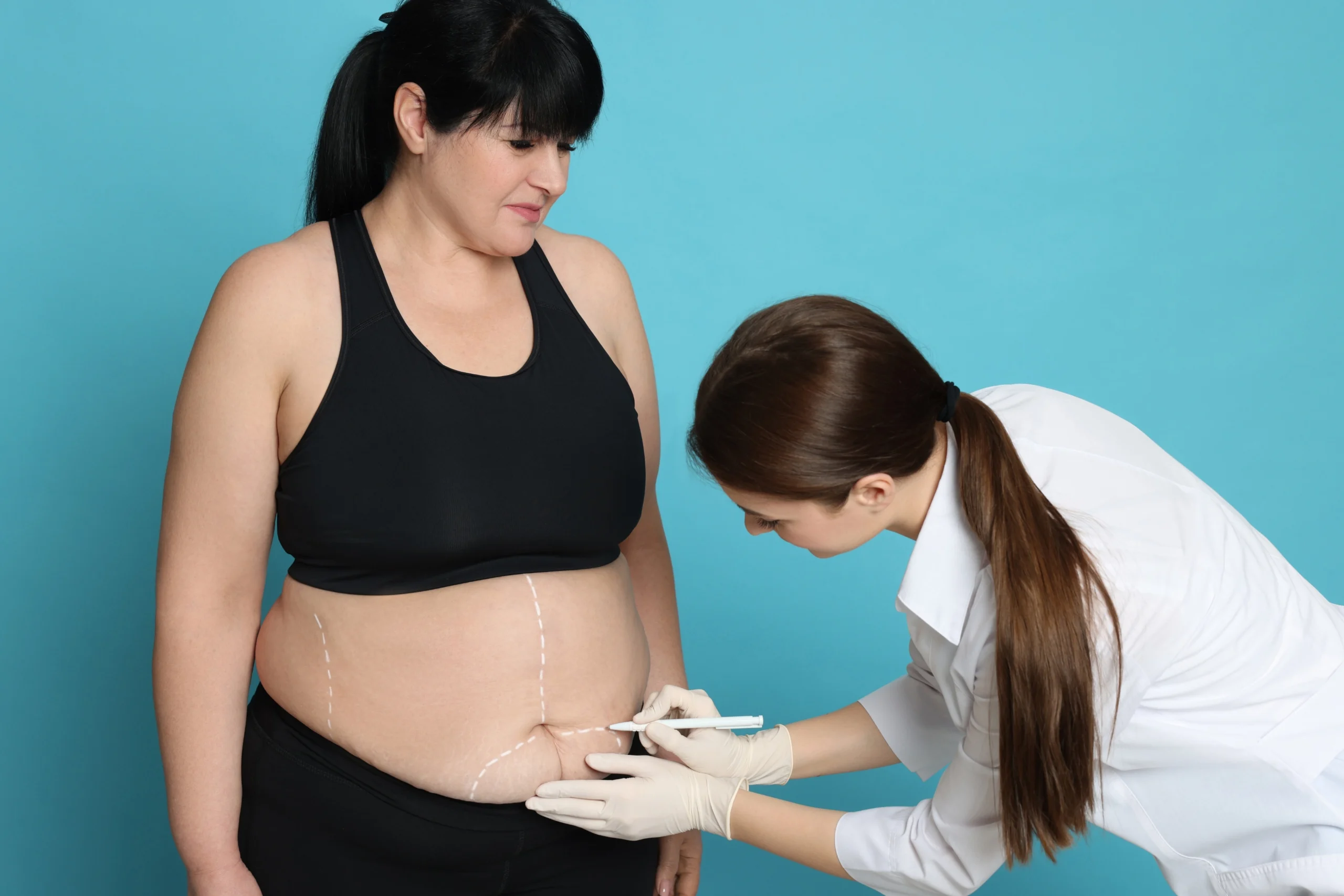 A side-profile view of a woman with dark hair in black activewear standing against a light blue background while a practitioner in a white coat and gloves draws white planning lines across her lower abdomen to map out abdominoplasty safety and recovery in UK.