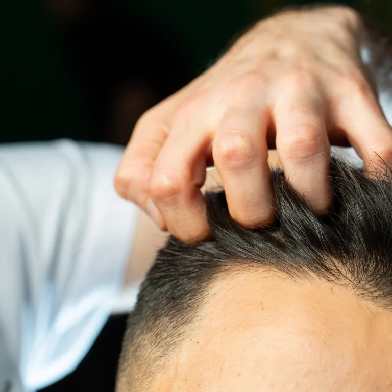 A close-up view of a clinician's hand running fingers through a man's thick dark hair to evaluate follicle distribution and frontal recessing for a FUE hair transplant UK procedure.