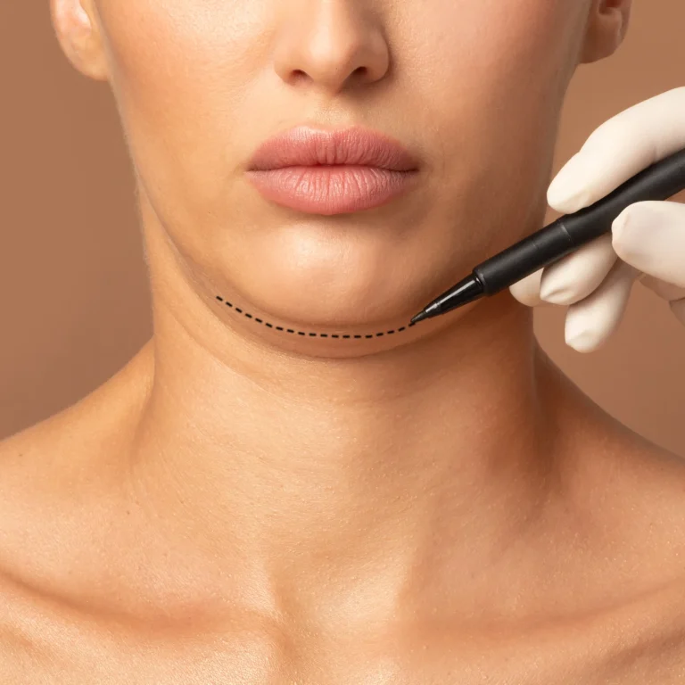 double-chin-removal-plastic-surgery-operation-concept-doctor-surgeon-hands-drawing-cut-line
