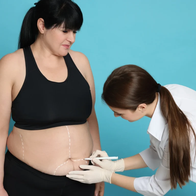A side-profile view of a woman with dark hair in black activewear standing against a light blue background while a practitioner in a white coat and gloves draws white planning lines across her lower abdomen to map out abdominoplasty safety and recovery in UK.