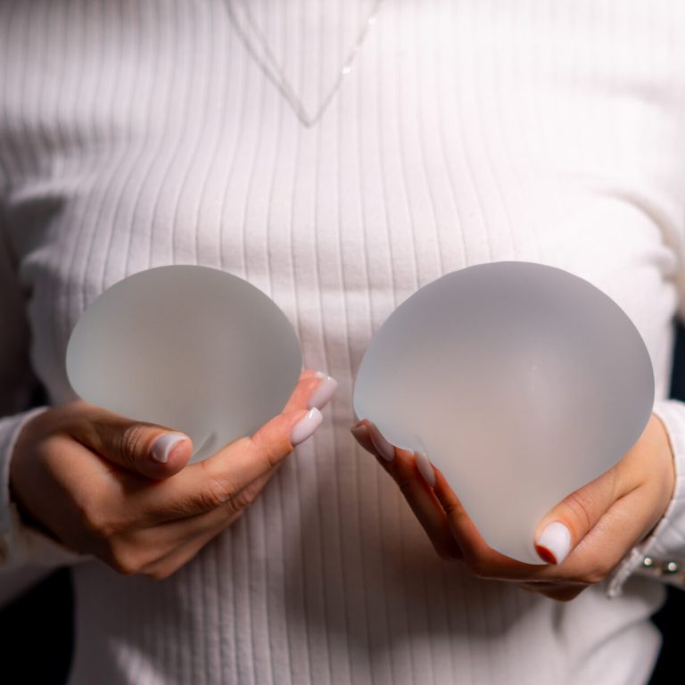 Woman with breast implants. A woman in a white long-sleeve top displays silicone breast implants in both hands.